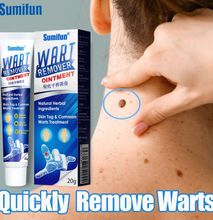 Sumifun Original Skin Tag Remover Warts And Moles Remover Skin Tag Removal Cream Ointment