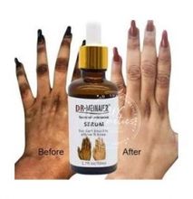 DR MEINAIER Strong Dark Knuckles Removal Serum 50ml