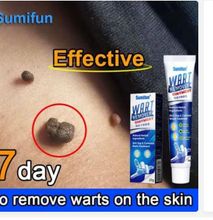 Sumifun Wart Remover Ointment Cream- 20g