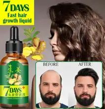 7 Days Germinal Hair Oil Growth Essence