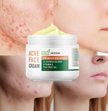 Vitamin E Tea Tree Oil Anti Acne Cream Herbal Treatment Skin Face Acne Scar Pimples Dark Spot Remover Skin Care Moisturize Cream