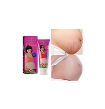 Aichun Beauty Stretch Marks Removal For Pregnant Women