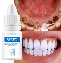 Efero Teeth Whitening Whitener