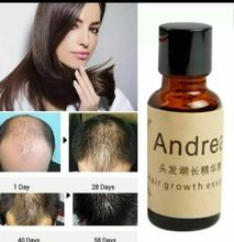 Andrea Hair Growth & Beard Growth Hair Loss Treatment Oil