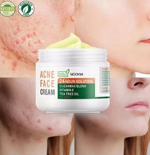 MOOYAM Acne Face Cream with vitamin E and Tear tree oil