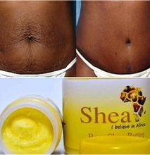 100% Raw Organic African shea Butter for Acne, Stretch marks, Dandruff,Eczema smooth skin-250G