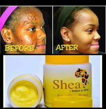 100% Raw Organic African shea Butter for Acne, Stretch marks, Dandruff,Eczema smooth skin-50G