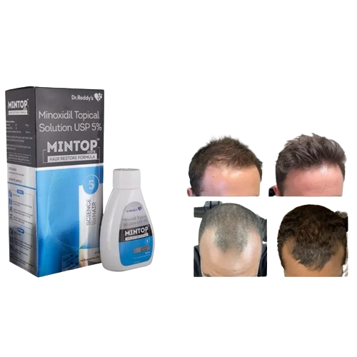 Buy Minoxidil 5% Solution Mintop Forte Restores Hair Prevents Male Pattern  Baldness in Kenya | Jamboshop